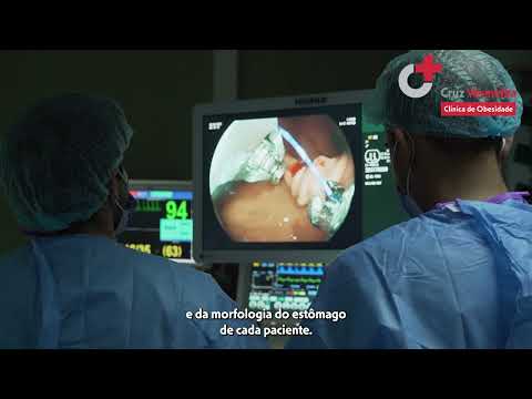 Endosleeve gástrico