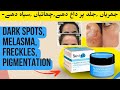 Best Pigmentation Cream داغ دھبوں کا مکمل خاتمہ The Skin Hub