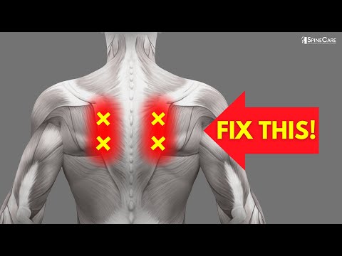 How to Fix Nerve Pain in the Shoulder Blades