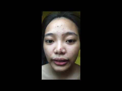 Upang mawala ang timbang sa 40 taon 30 kg Manipis na katawan ng larawan