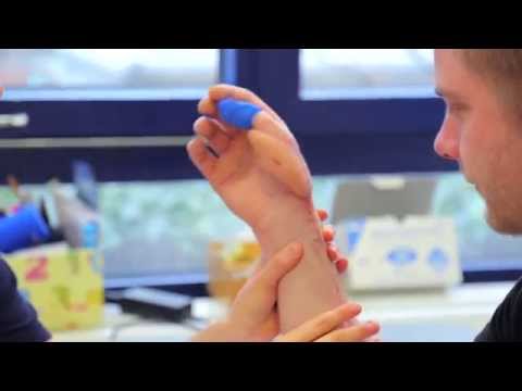 Frontzugang der Halswirbelsäule Ellenbogen Bursitis Behandlung Antibiotika