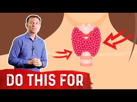 Hyperthyroid vs Hypothyroid Explained By Dr Berg