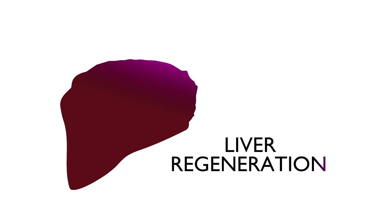 What is nodular regeneration of the liver? More REF