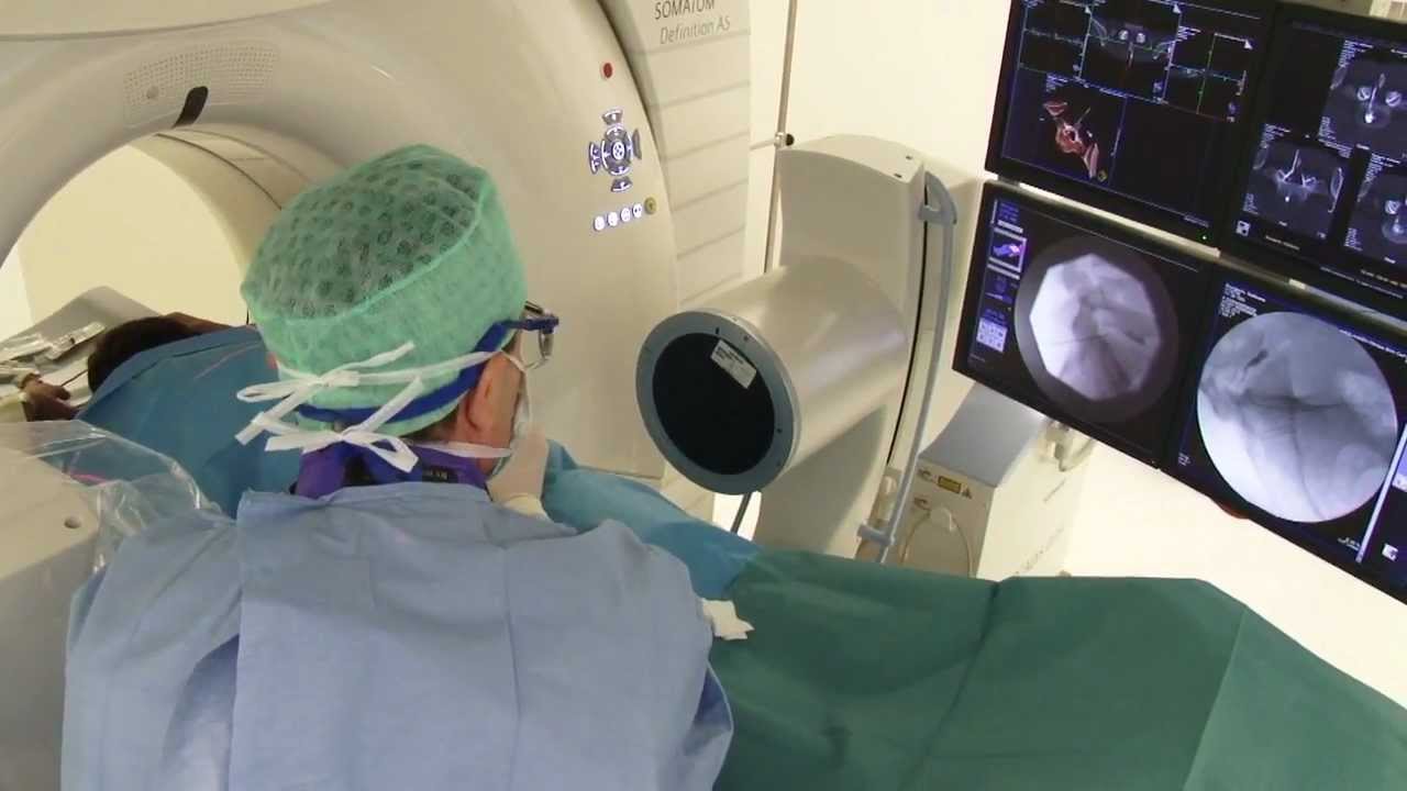 La herniectomie, une technique révolutionnaire