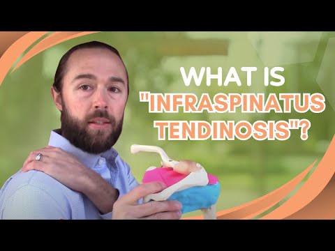 What is "Infraspinatus Tendinosis"? (shoulder pain)