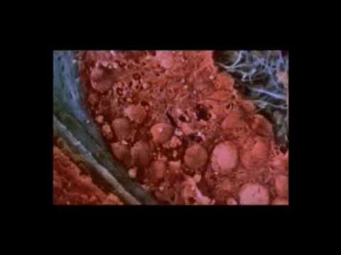comment augmenter les spermatozoides chez l'homme