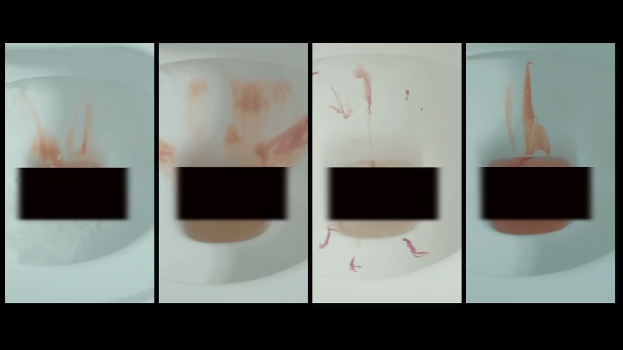 Colorectal Cancer - What else should you do in the toilet?