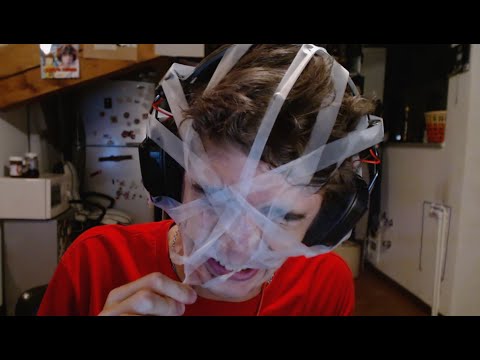 Creme di decolorazione di faccia in farmacie Il peeling da pigmentary nota su un dorso
