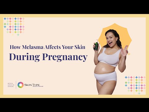 How to Prevent and Treat Melasma During Pregnancy