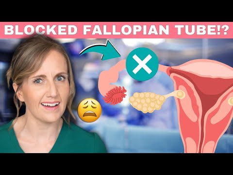 What can cause blocked fallopian tubes?