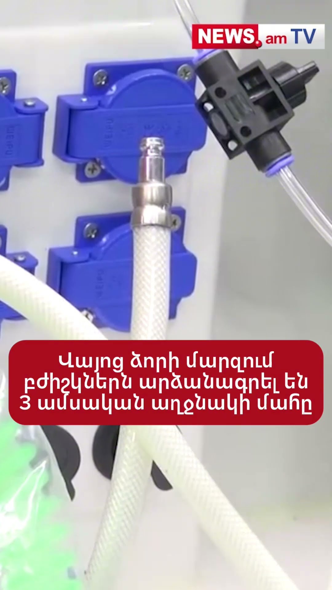 Վայոց ձորի մարզում բժիշկներն արձանագրել են 3 ամսական աղջնակի մահը