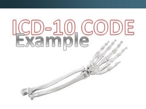 How to Code Correctly with ICD-10