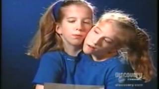 Abby (Abigail), and Brittany Hensel Conjoined Twins. Two heads, two souls in one body