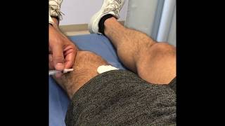 Extracción de liquido sinovial Bobby Pulido