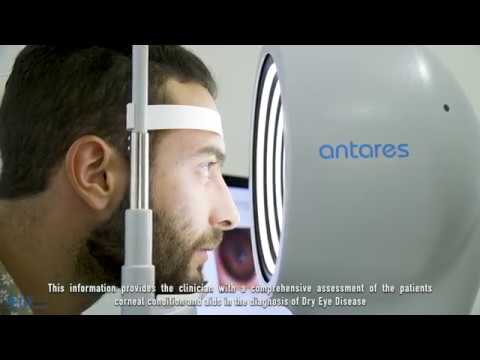 אנטריס Antares
