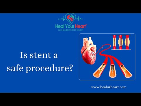 Is Stent a Safe Procedure?  Risks and Benefits Explained