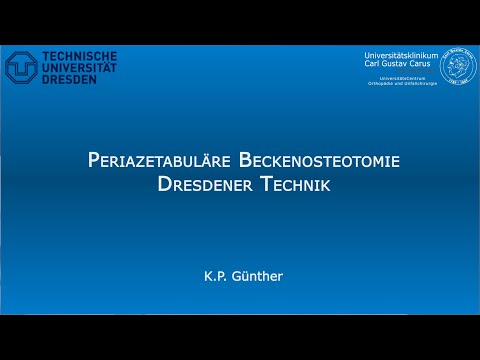 Alle möglichen Zeichen der Osteochondrose Entwicklung nach dem Bruch des Ellenbogens