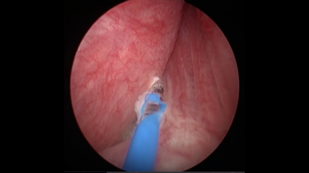 Miguel Angel Rodríguez Cabello-15