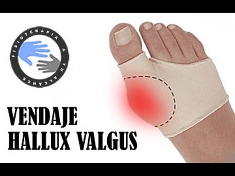 Vendaje para juanetes o hallux valgus