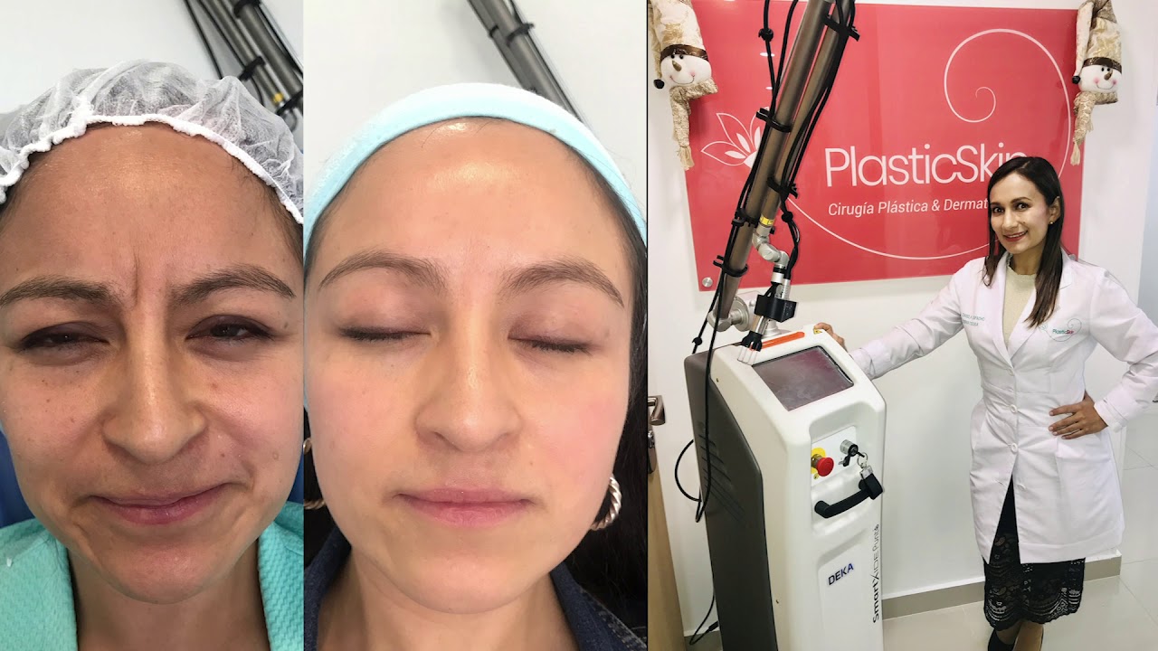 Dariela Capacho Estrada-29