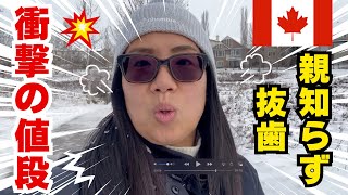 【衝撃！】カナダで親知らずを抜いたら衝撃の金額だった！カナダへ渡航予定の方必見！アドバイスとカナダの歯科治療の解説