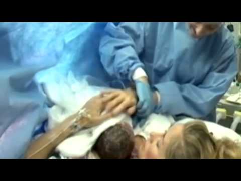 Gentle C-Sections offers new moms a way to bond with their newborns