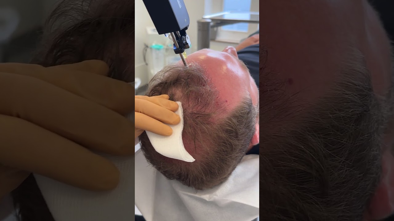 Lars Steinsträßer-28