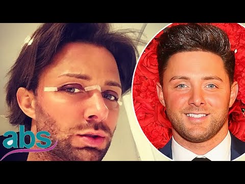 Former Geordie Shore star Ricci Guarnaccio shows off surgery results  | ABS US  DAILY NEWS