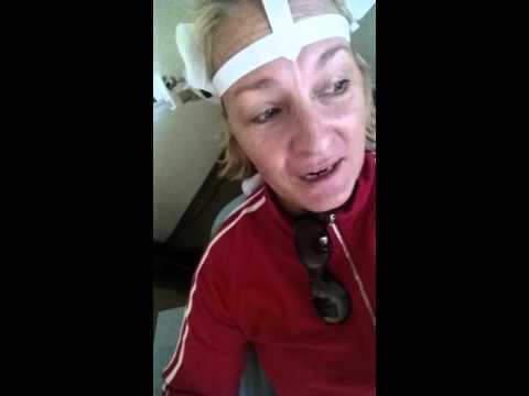 TMS THERAPY, Day #7,video, Transcrainial Magnetic