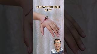 Download lagu TANGAN KENA SILET TAJAM #funnydubbing #funny #shortsfeed #trending #shorts mp3 Download lagu TANGAN KENA SILET TAJAM #funnydubbing #funny #shortsfeed #trending #shorts mp3