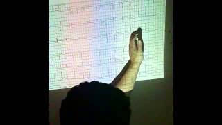 Dr.Mohamed Mansour [Practical : ECG - Video]