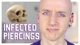 Infected Piercings & How To Heal Them | Piercing FAQ 21 | Roly