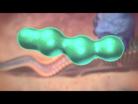 Wie Schmerzen entstehen