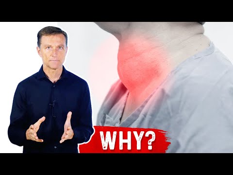 The Benefits of Iodine Side Effects and More