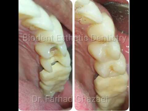 BioDent Esthetic Dentistry- Dental clinic and Implant Center in Budapest / Hungary