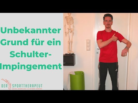 Der unbekanntere Grund für das Impingement Syndrom und wie du es endlich lösen kannst