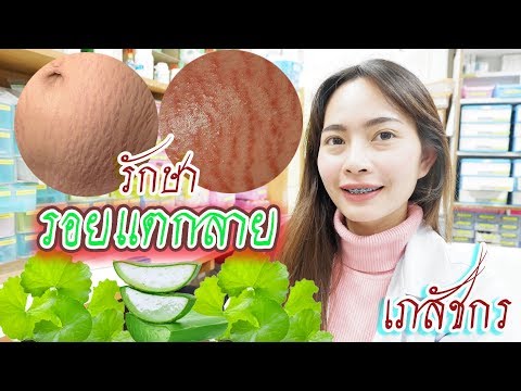 ข้อห้ามสำหรับการนวดกลาก ฉลาดจากโรคสะเก็ดเงิน
