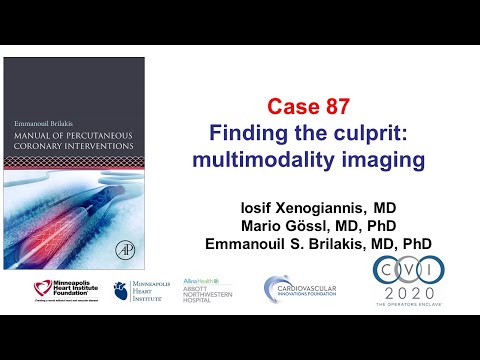 Case 87: PCI Manual - MRI + OCT to find NSTEMI culprit