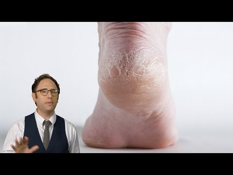 You're Running Wrong! | YDIW with the Sklar Brothers