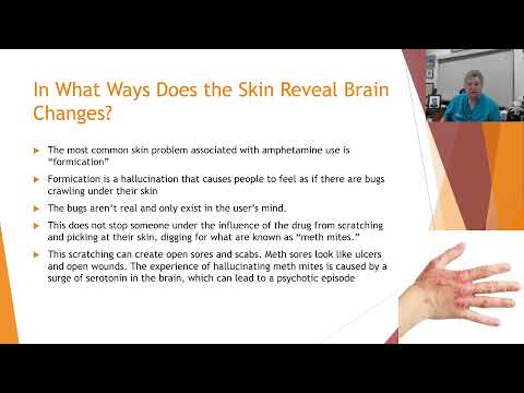 The Brain-Skin Connection Series: 9. In What Ways Does the Skin Reveal Brain Changes?