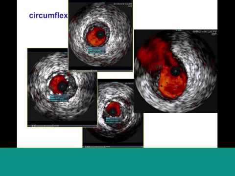 THe New Era of Protected PCI webcast