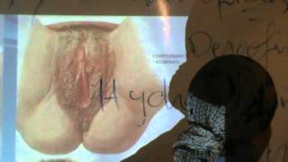 Gynacology - Dr.Nadine Alaa Sherif - Valvular Lesions    - Part 2