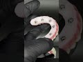 Full zirconia implant prosthesis