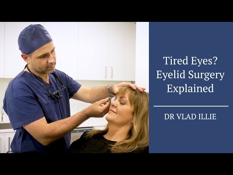 Upper & Lower Blepharoplasty Explained | Eyelid Surgery with Dr. Vlad ILLIE