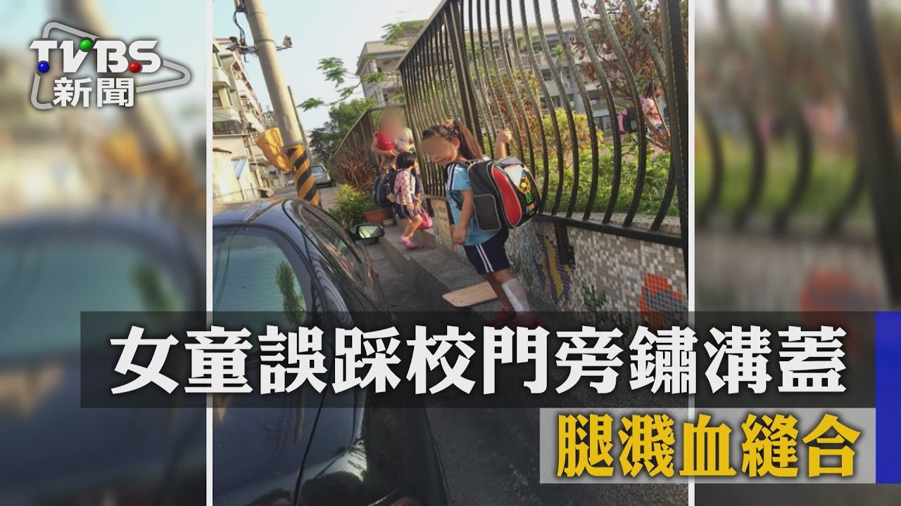 痛啊！女童割傷好長一條　都是「水溝蓋」害的