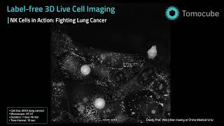 NK Cells Attacking Lung Cancer Cells | 3D Timelapse by Holotomography
