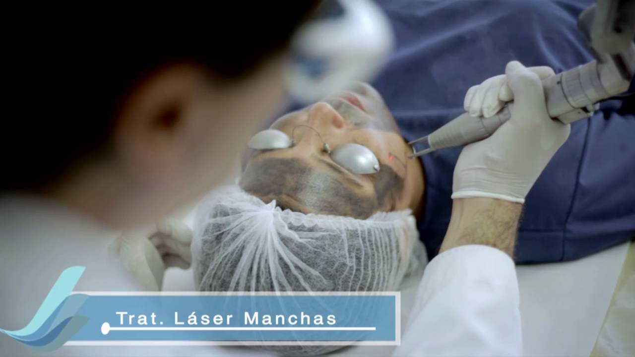 Tratamiento con Láser Q-Switch para manchas