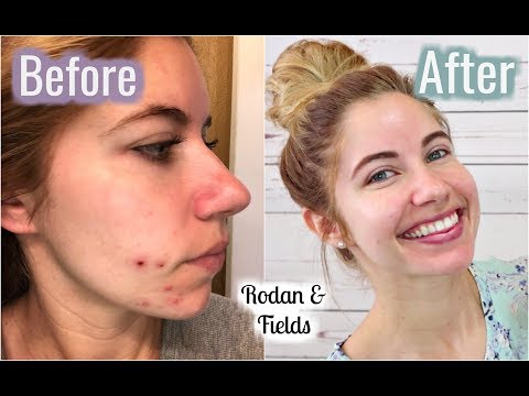 download lagu mp3 mp4 Unblemish Regimen, download lagu Unblemish Regimen gratis, unduh video klip Unblemish Regimen