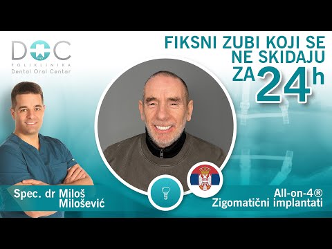 Novi zubi za 24h - Lepi Mića - Iskustvo pacijenta