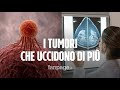 Cancro Ecco Quali Sono I Tumori Che Uccidono Di Più In Italia Muoiono 500 Persone Al Giorno